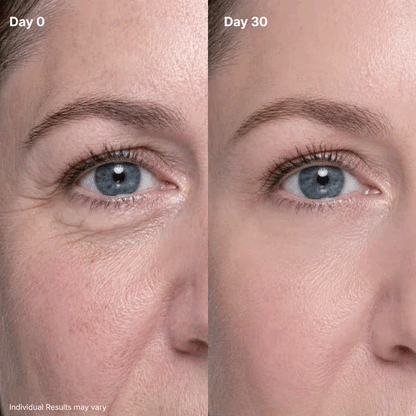 Eye Renewal Cream