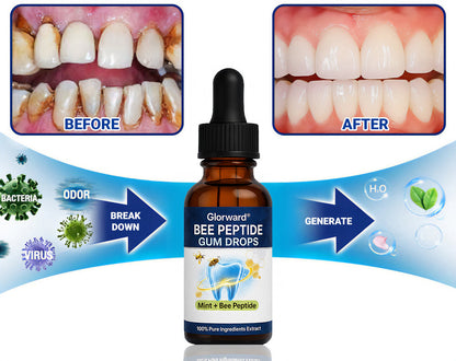 Glorward Dental treatment drops and a regular mouthwash