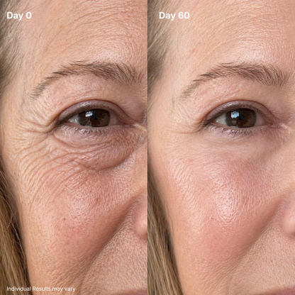 Eye Renewal Cream